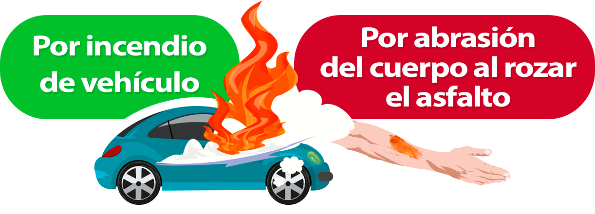 tipos de quemaduras